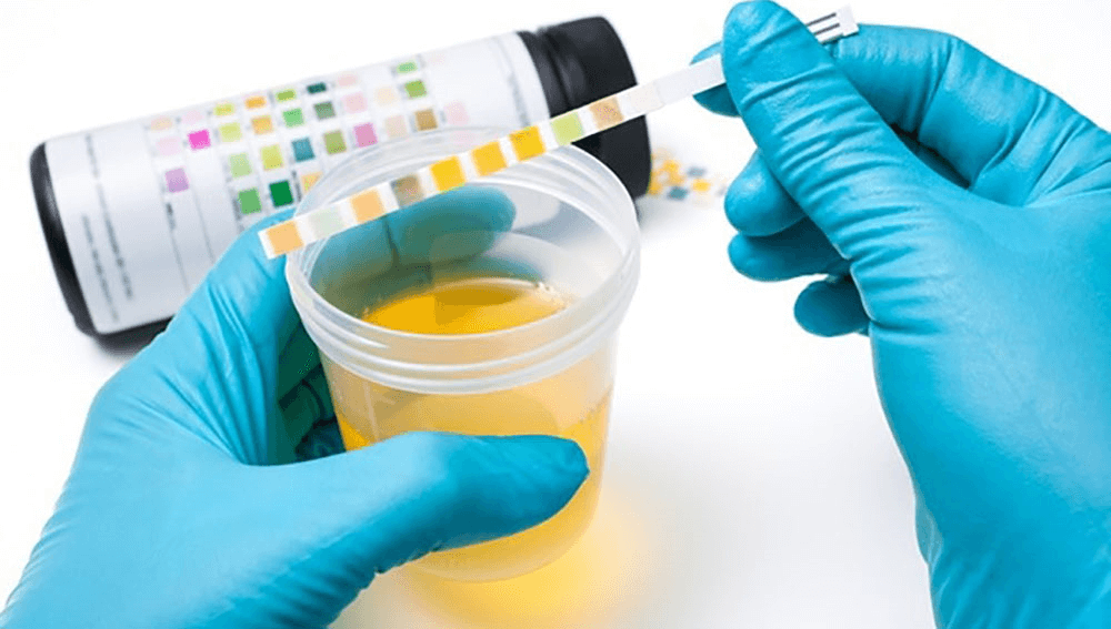 Finding the Best Synthetic Urine